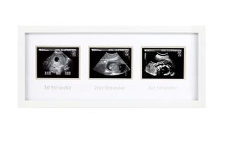 10 Best Baby Picture Frames for Cherishing Precious Memories- 4