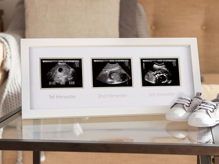 No. 6 - Pearhead Trimester Progression Sonogram Picture Frame - 2