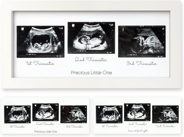 No. 10 - KeaBabies Trio Baby Sonogram Picture Frame - 1