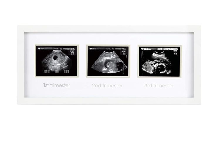 No. 6 - Pearhead Trimester Progression Sonogram Picture Frame - 1