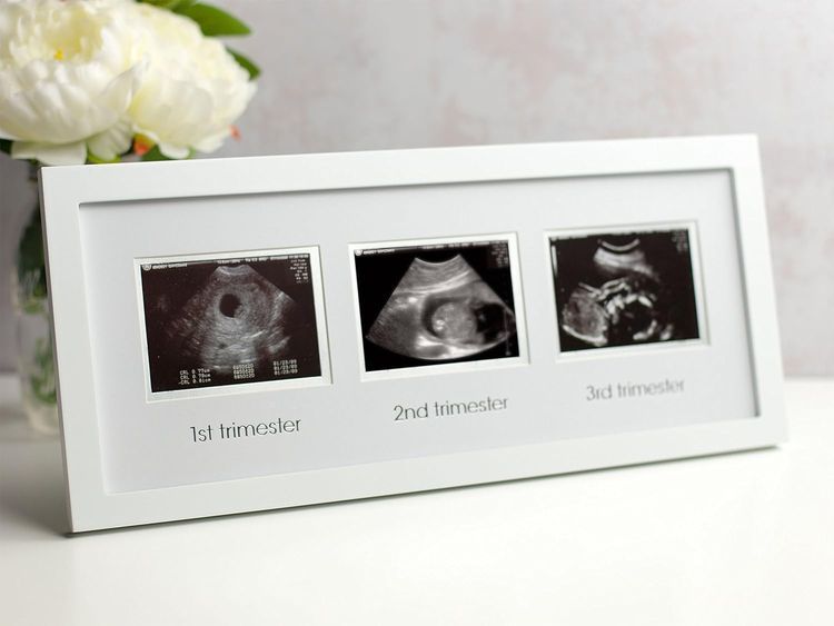 No. 6 - Pearhead Trimester Progression Sonogram Picture Frame - 5